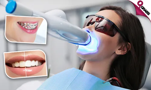 Perfect your Smile with Zoom Teeth Whitening, Dental Braces or Veneers!